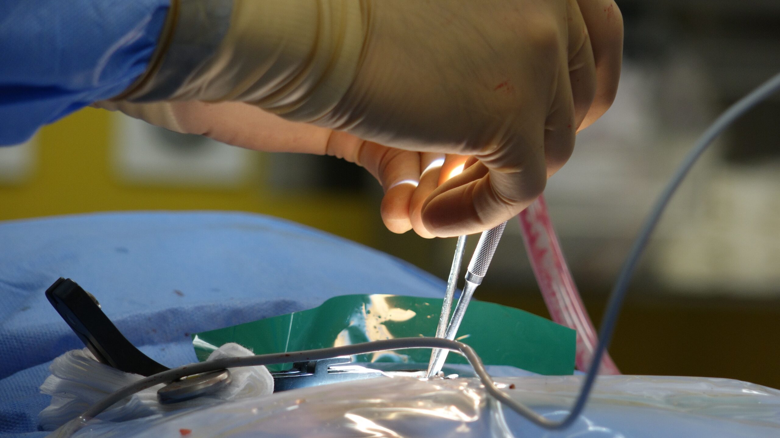 Stem cell therapy research for spinal cord injury showing neural cells being transplanted into damaged spinal cord
